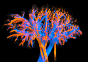 Multi-lens ultrasound arrays enable large scale three-dimensional micro-vascularization characterization over whole organs