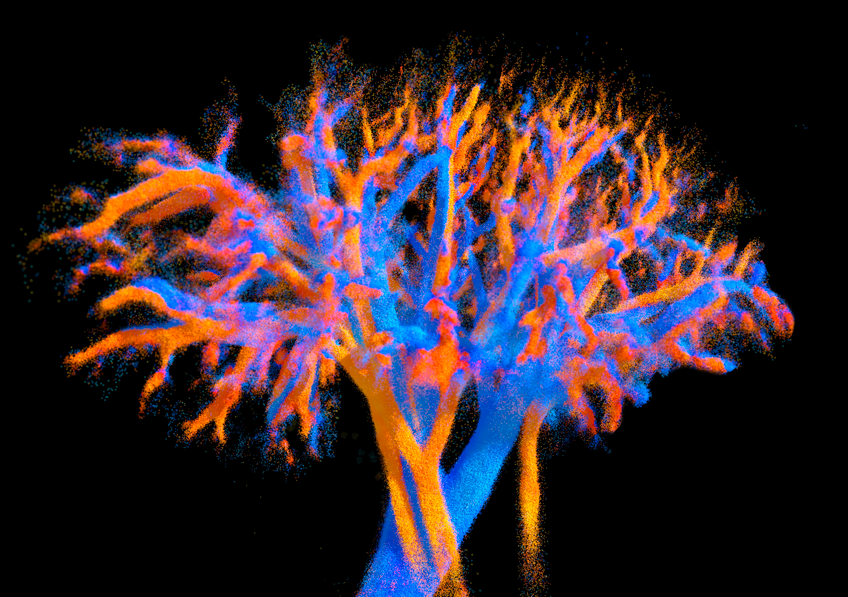 Multi-lens ultrasound arrays enable large scale three-dimensional micro-vascularization characterization over whole organs